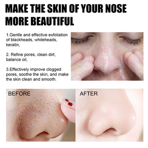 100% Tự Nhiên Hữu Cơ Than Tre Mặt Xà Phòng Rắn Thanh Sâu Làm Sạch Tẩy Tế Bào Chết Với Màu Đen Bùn Bán Buôn - Product Image 6