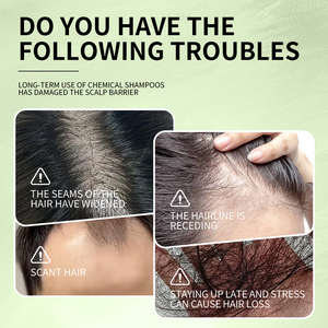 Xà phòng ushman tùy chỉnh để điều trị tăng trưởng tóc | xà phòng chăm sóc tóc tự nhiên & hữu cơ - Product Image 4