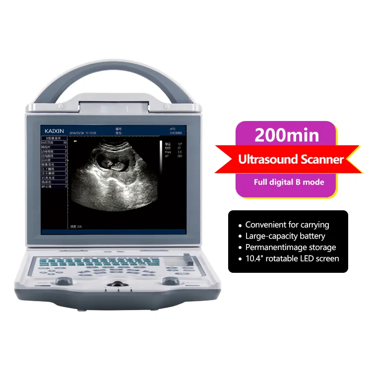 Alat pemindai diagnostik ultrasonik, peralatan medis pemindai diagnostik Ultrasound Full Digital portabel
