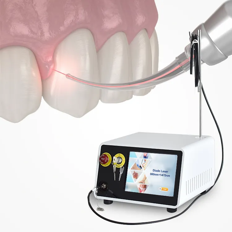 2023 hot Professional Medical Equipment Dental Soft Tissue Laser Machine 980nm 1470nm Diode Laser Teeth Whitening Instrument