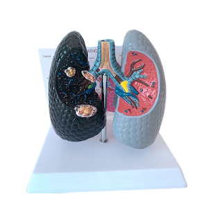 Anatomia umana fumare salute polmonare e patologia bronco confronto modello di insegnamento - Product Image 1
