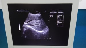 Ультразвуковой сканер с полной конфигурацией зонда - Product Image 4