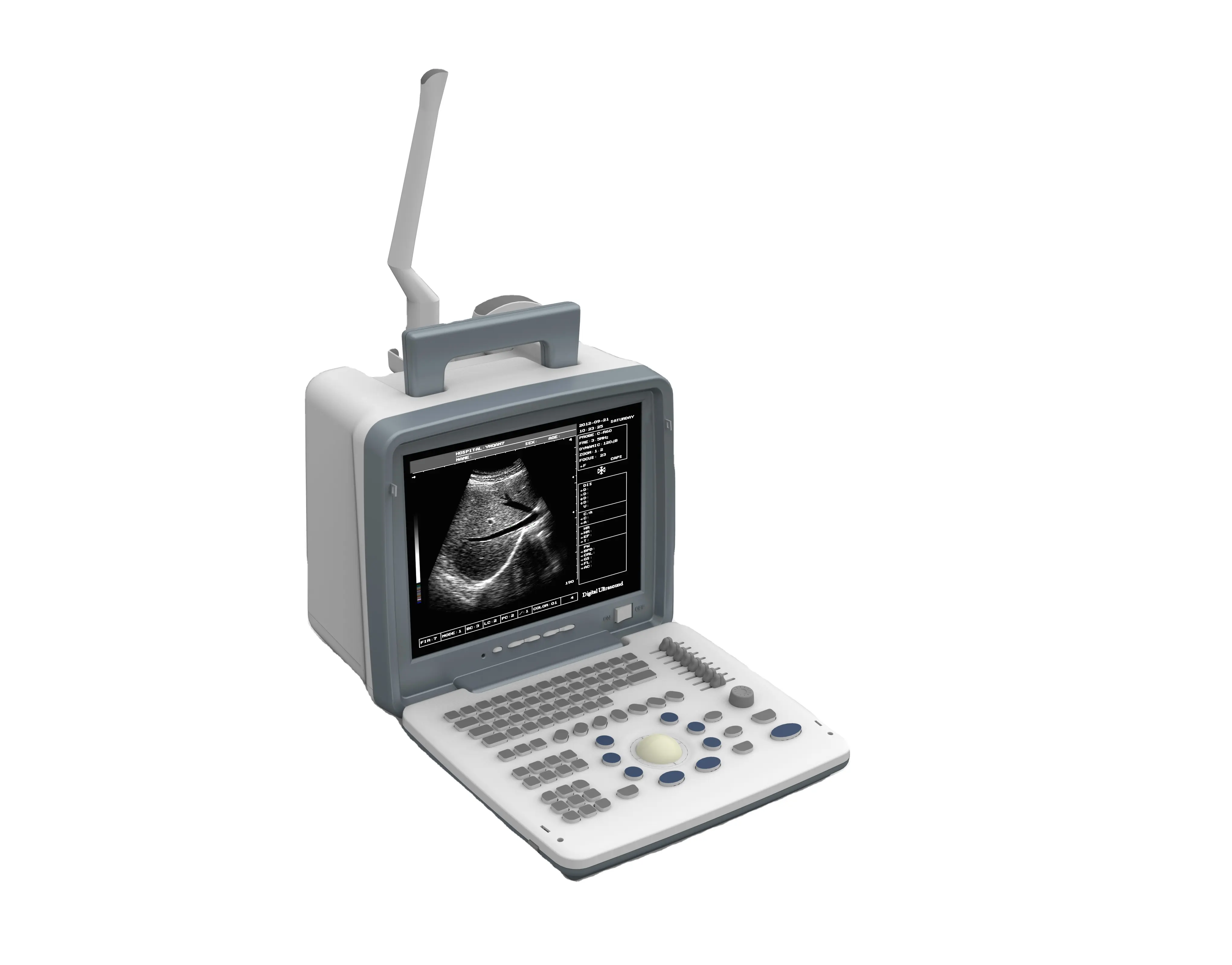 Test de grossesse Scanner à ultrasons 3D système de Diagnostic à ultrasons