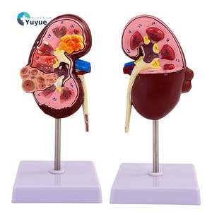 病気の腎臓と尿システムをシミュレートする人間の教育のための解剖学的PVC腎臓モデル