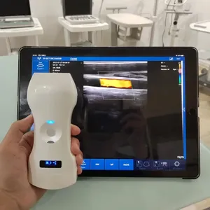 最も鮮明な画像192要素3 in 1ワイヤレス超音波プローブusg for thyroid、pregnancy、heart for vet use - Product Image 2