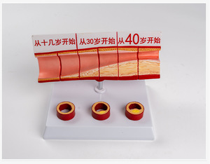 SCIEDU Age <strong>Group</strong> Large Blood Vessel Model 4 Parts <strong>Human</strong> Anatomy Model Sclerosis Cardiovascular Arteriosclerosis Pathology Model