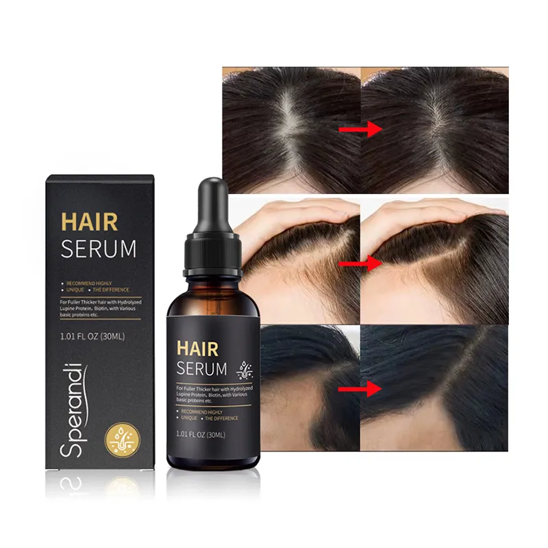 Anti hair loss treatment serum ginger oil serum hair regrowth care vitamin b5 biotin hair growth serum oil for men and women