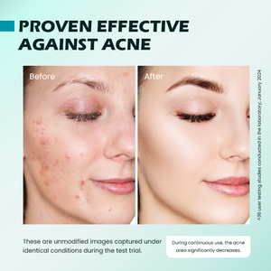 Chống mụn trứng cá mặt huyết thanh Niacinamide Hữu Cơ Salicylic acid cho lỗ chân lông đốm đen giảm nếp nhăn cải thiện kết cấu da - Product Image 6