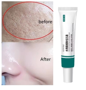 Hot Salicylic Acid <strong>Pore</strong> Shrinking Cream Quick Elimination Large <strong>Pores</strong> Remove Blackehead Tighten Face Smooth Skin Care 30g - Product Image 2