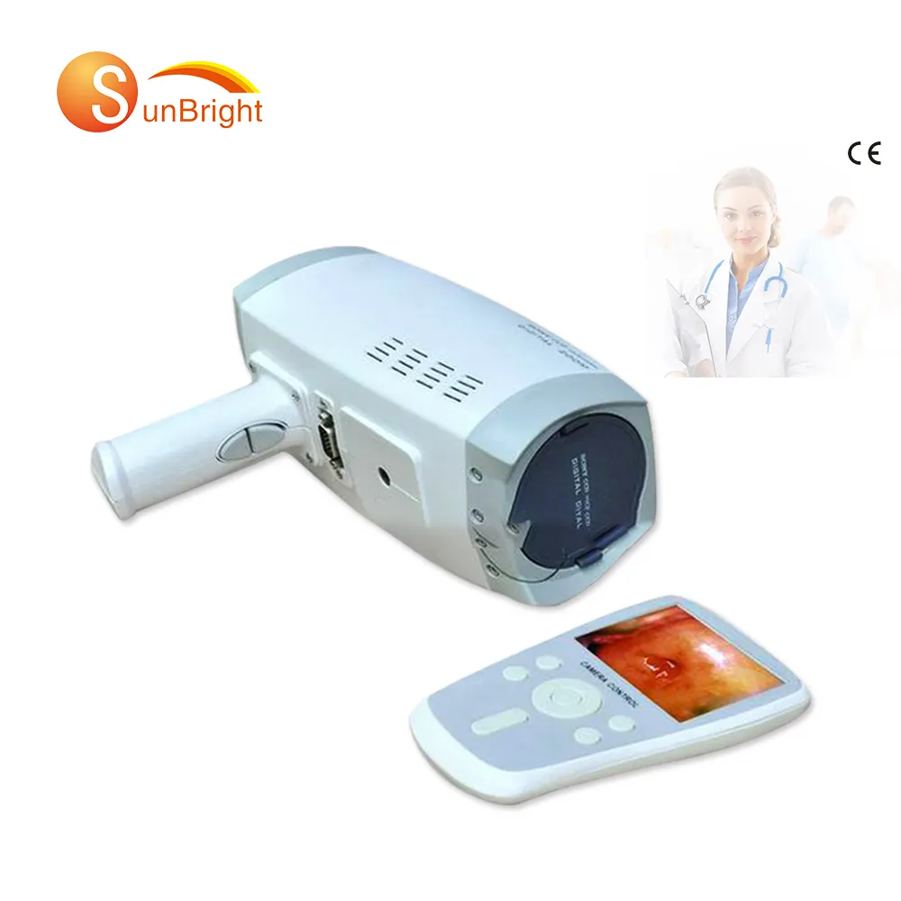 Dispositivos de imagen médica profesionales portátiles, colposcopio de vídeo para ginecológica