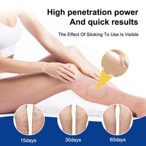 Dermfree giãn tĩnh mạch Kem-Cứu trợ tự nhiên cho chân sưng & nhện 60g - Product Image 5