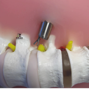 Transforaminal Endoscope Simulation <strong>Human</strong> <strong>Back</strong> Model TESSYS Model Lumbar Disc Herniation Training Model - Product Image 3