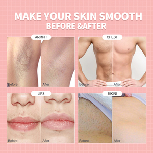 Đa Năng Thấp Meltingtemperature 100G Đen Tóc Loại Bỏ Lông Cứng Sáp Đậu Cho Nam Giới - Product Image 4