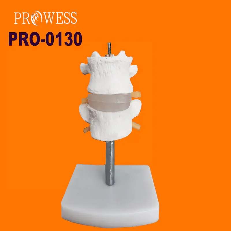 PRO-0130 Clear display vértebras lombares normais combinação 2, 3, 4, 5 seções do modelo de esqueleto humano