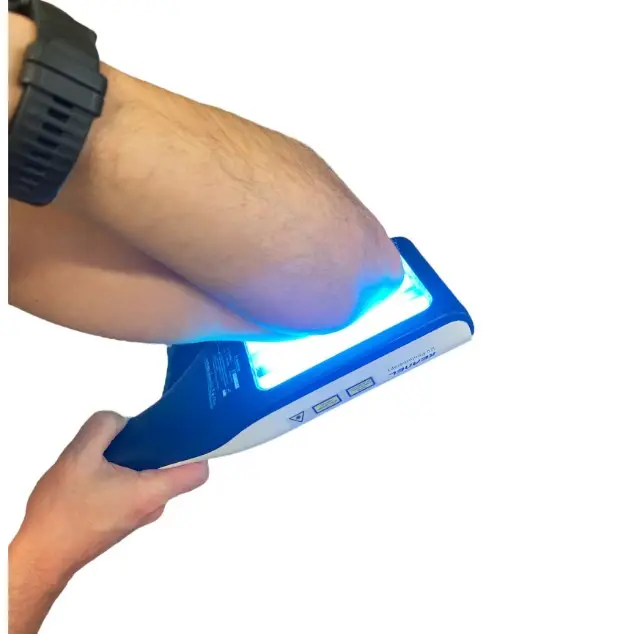 Luz UV de 311nm, dos lámparas, instrumento de fototerapia, lámpara de Psoriasis para Vitiligo UVB, núcleo de fototerapia