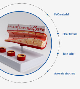 SCIEDU Age <strong>Group</strong> Large Blood Vessel Model 4 Parts <strong>Human</strong> Anatomy Model Sclerosis Cardiovascular Arteriosclerosis Pathology Model