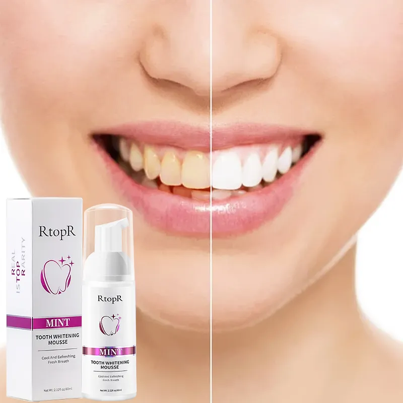 RtopR Tooth Cleansing Removes Stains Teeth Oral Hygiene Mousse Toothpaste Whitening and Staining 60ml