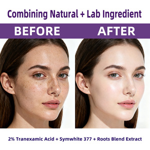KARANLIK LEKE SERUMU Nemlendirir, Cildi Arındırır, Cilt Tonunu Aydınlatır ve Nemlendirir - Product Image 5