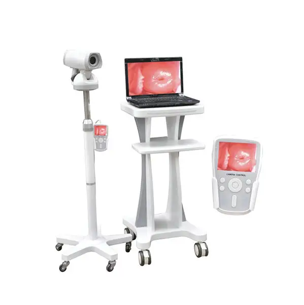 Endoscopio médico Colposcopio portátil Colposcopio de video digital para Ginecología