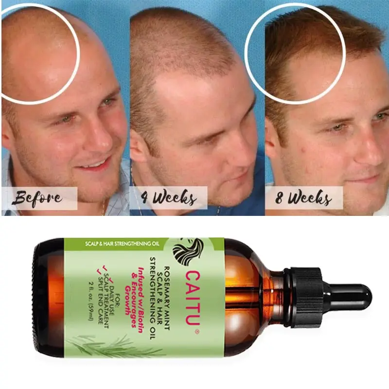 Private Label Repairing Hair Care Treatment Anti Loss Regrowth Treatment Scalp Hair Serum Oil Hair Growth Oil Serum