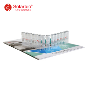 Solarbio สารละลาย Alizarin Red S (1%, PH4.2) สำหรับการวิจัยทางวิทยาศาสตร์ - Product Image 4
