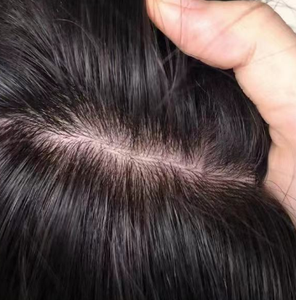 Base de seda completa atada a mano para mujer, Topper natural transpirable, uso de verano, sistema de postizo de integración de cabello virgen humano 100% - Product Image 5