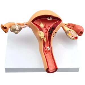 Pathological Model of <strong>Uterus</strong> - Product Image 3