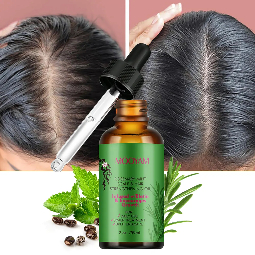 Aceite orgánico de menta de Romero para el cuero cabelludo y el cabello con biotina y aceites esenciales, aceite de Romero multiusos