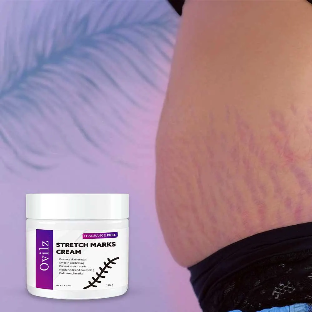 OEM Ovilz Scars Removal Cream Triple Action Formula Pregnancy cream for stretch marks