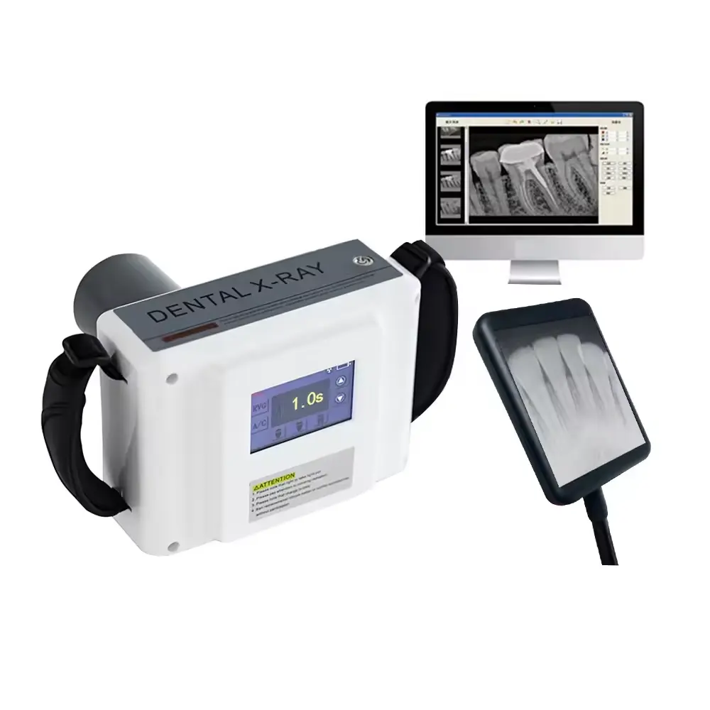 Produttore cinese sistema di immagine a raggi X digitale portatile ad alta frequenza con sistema di immagini a raggi X dentista macchina dentale a raggi Xray