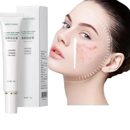 À base de plantes élimination de l'acné crème pour le visage contrôle de l'huile Anti-acné Gel traitement acné marque soins de la peau blanchissant éliminer les boutons crème pour le visage
