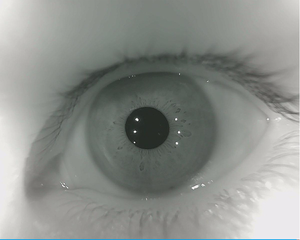Módulo de cámara de reconocimiento ocular de reconocimiento de IRIS de 5MP Módulo de cámara USB con filtro de banda estrecha de 850nm - Product Image 2
