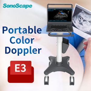SonoScape E3 לב כלי דם דיגיטלי צבע דופלר נייד אולטרסאונד מכונת