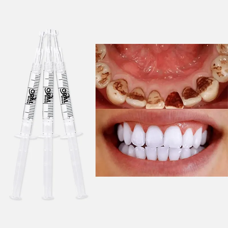 Профессиональный безопасный набор для отбеливания зубов 16% отбеливания зубов гель для отбеливания зубов частная этикетка отбеливающий набор для отбеливания зубов