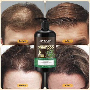 Fabriek Oem Natuurlijke Biologische Custom Veganistische Haaruitval Rozemarijn Mint Tea Tree Olie Haargroei Shampoo - Product Image 1