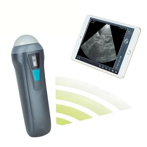 Machine à ultrasons vétérinaire Ecografo Portatil Veterinaria Handheld Mini Doppler couleur linéaire Wifi Scanner à ultrasons sans fil - Product Image 6