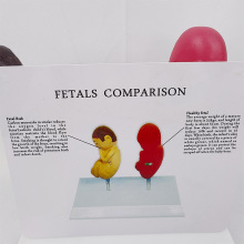Comparative Model of Smoking Effects on <strong>Fetuses</strong> Medical Science Product - Product Image 2