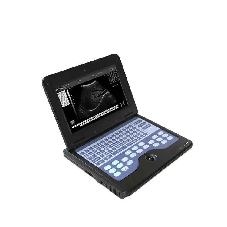 CONTEC CMS600P2 ecografo portatile Doppler ad ultrasuoni per laptop