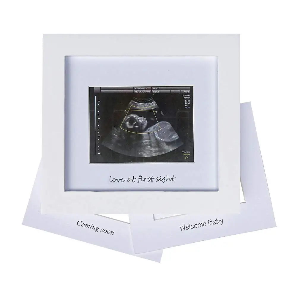 Weißer Ultraschall Fotorahmen Neugeborenes Geschenk Souvenirs Baby Ultraschall Bilderrahmen Liebe Andenken