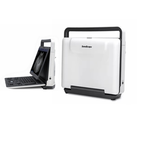 E1 E2 E2v <span class=keywords><strong>Sonoscape</strong></span> Portátil Ultrassom Scanner Ecocardiógrafo Doppler Colorido - Product Image 6