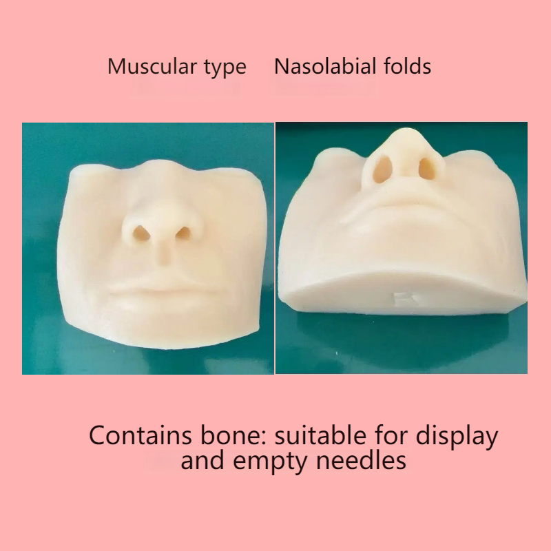 Sillons nasogéniens de type musculaire bleu