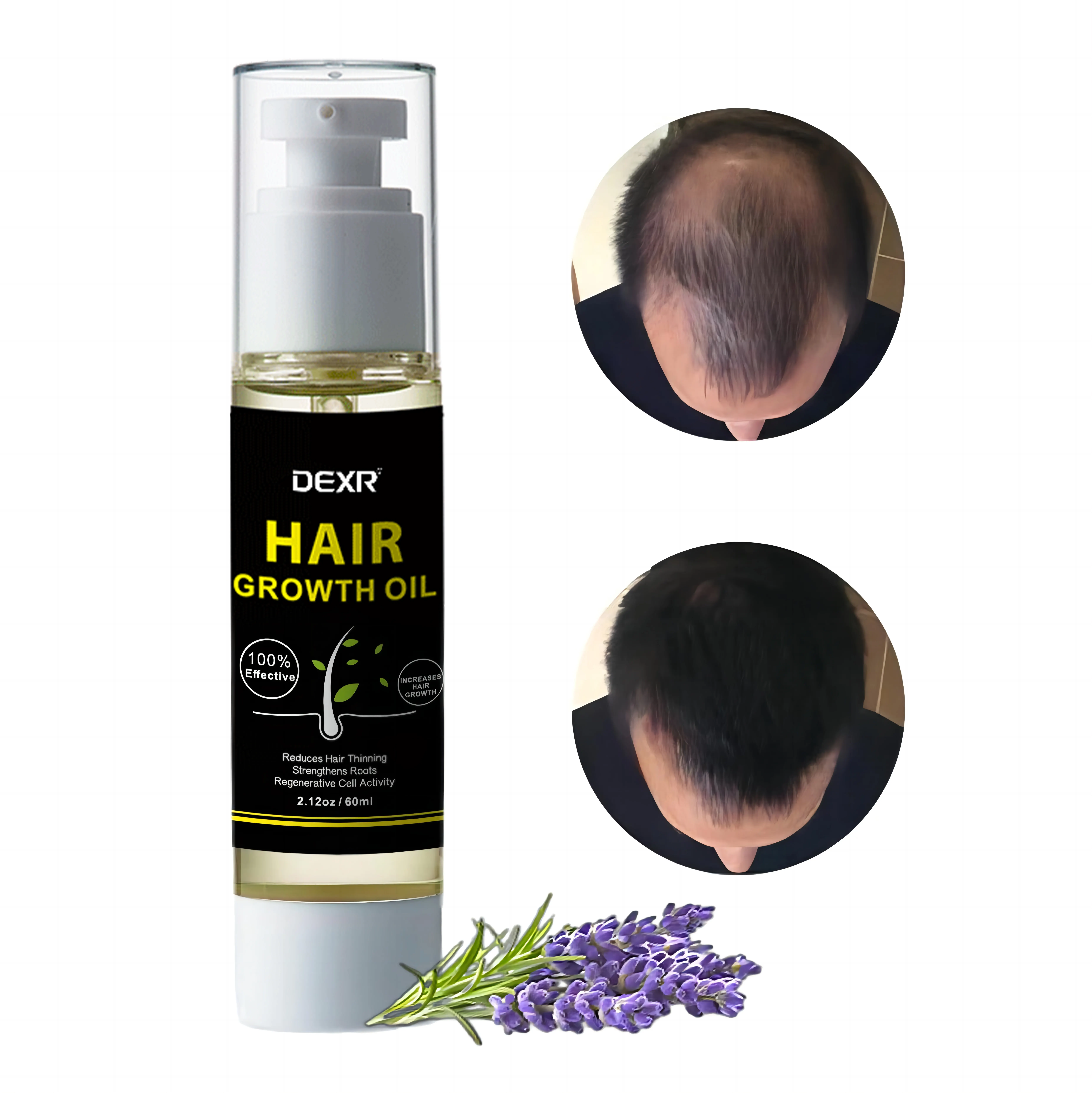 OEM-Haarbehandlung Produkte Anti-Haarausfall 100 % natürlich Pflanzen Ätherisches Öl Haarwachstumsöl