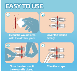 Alat perawatan luka, perangkat penutup luka steril darurat rumah medis dengan lem perekat ritsleting - Product Image 6
