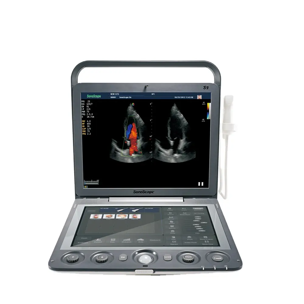 Sonoscope S9 3D 4D portable, de marque célèbre, prix de machine à ultrasons