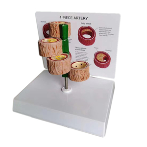 <strong>Human</strong> Vascular Thrombus Anatomical Model Blood Vessels Pathology Model for Medical Teaching - Product Image 5