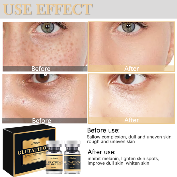 Y Korea Glutathione Lyophilized Powder Kit Glow Serum Collagen Whitening Spot Removal Wrinkles Remover Multi Glutathione Serum