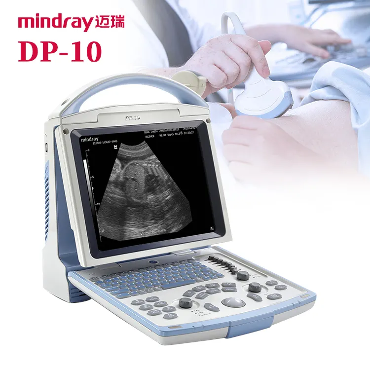 Mindray DP-10 Ultrasound Système d'imagerie diagnostique ultrasonique numérique complet B/W Machine à ultrasons portable