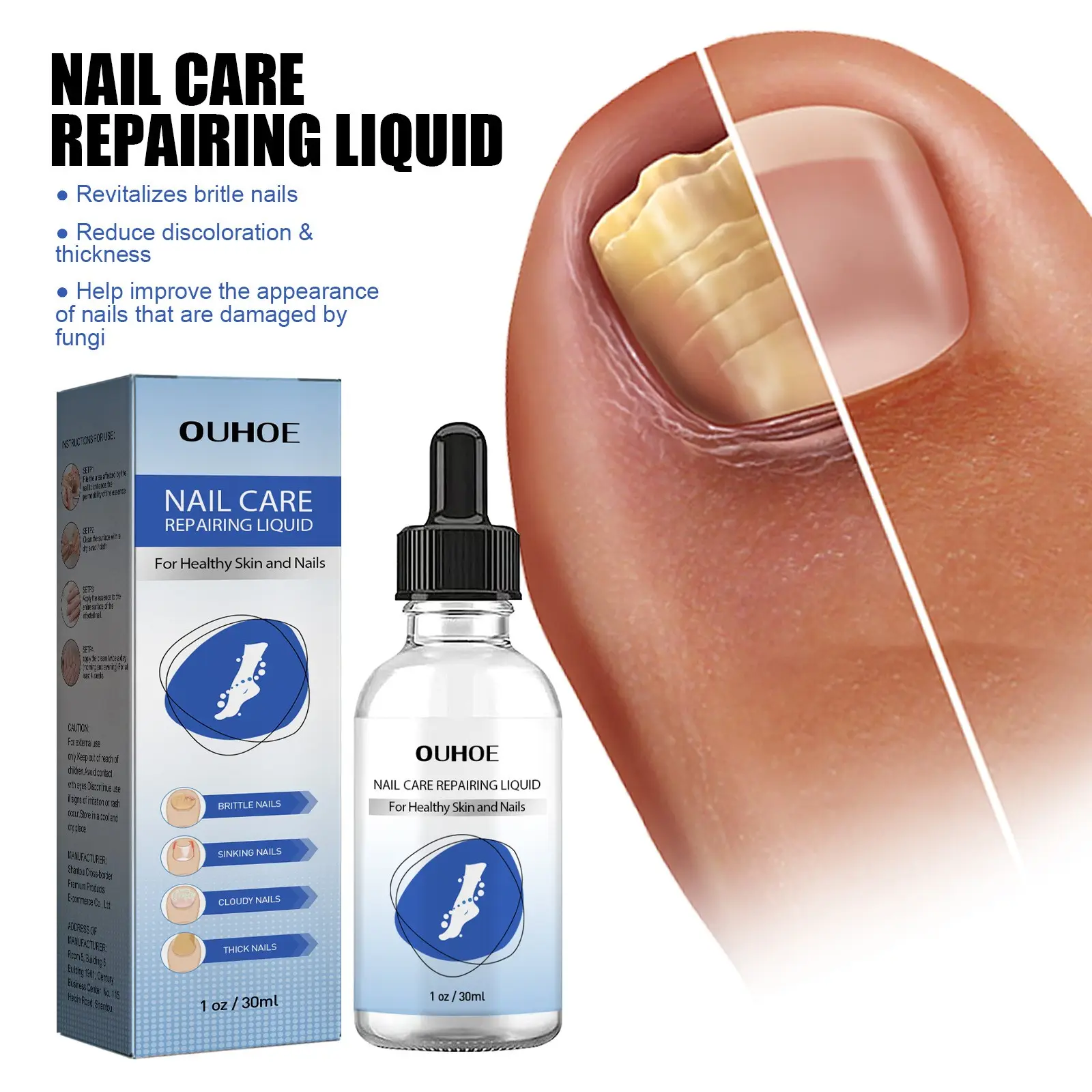 Custom Logo Cheap Cuticle Oil Nourishing Moisturizing Foot Nail Fungus Treatment Serum MSDS Foot Care Finger Nail Skin Care