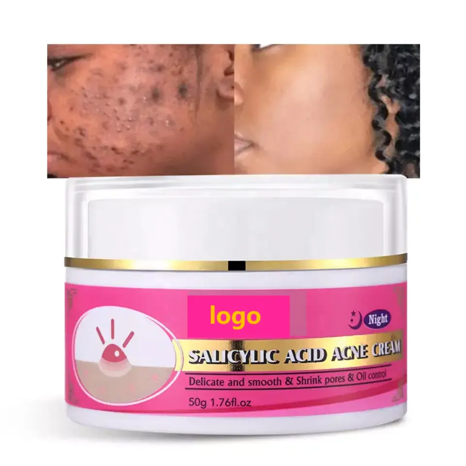 Private Label Organic Natural Pimple Removal Facial Skincare Acne Treatment Salicylic Acid Cream Anti Acne Face Cream