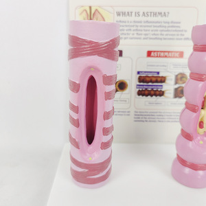 Comparison Model of Normal and Diseased Trachea in the Human Body with Comprehensive <strong>Explanation</strong> Base Medical Science Product - Product Image 2